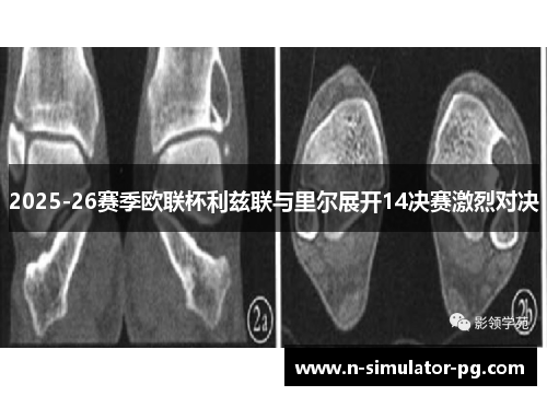 2025-26赛季欧联杯利兹联与里尔展开14决赛激烈对决